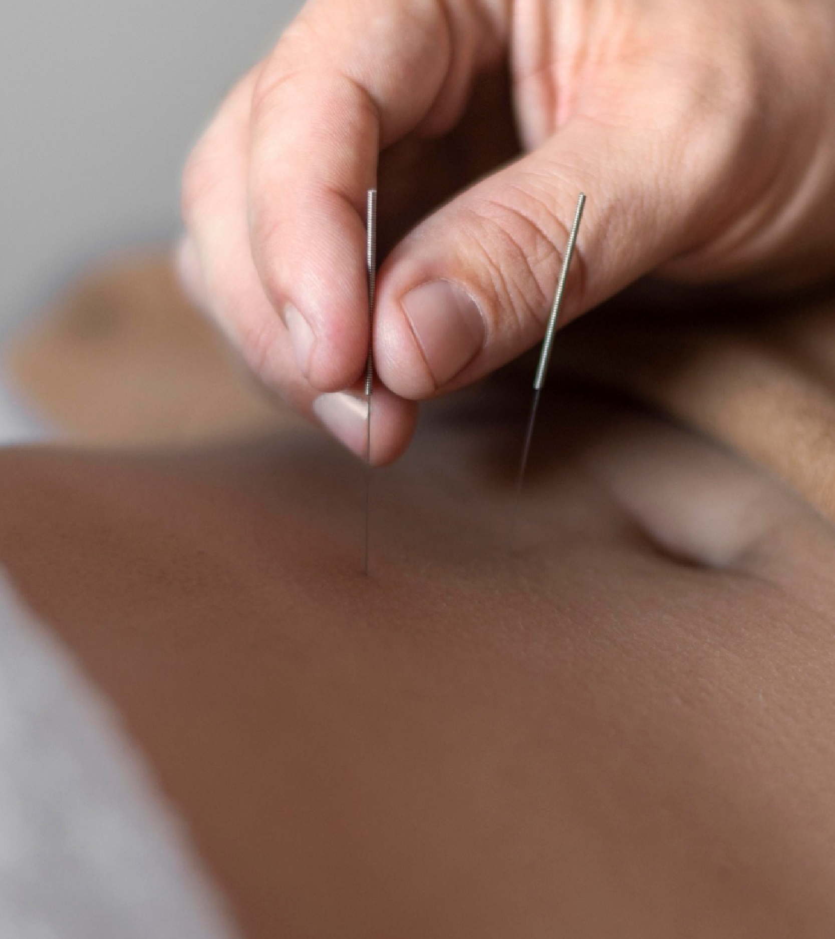 skin health acupuncture