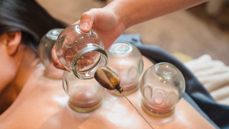 Glass cupping therapy on the back 拔罐